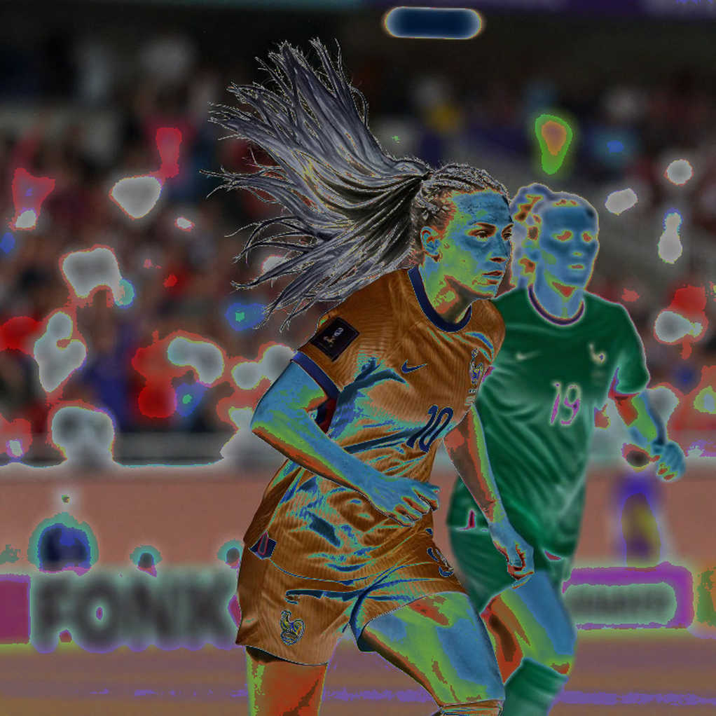 Decoding Nguyen Xuan Son's injury: the tibia-fibula fracture mechanism and a recovery with no spectators Decoding Nguyen Xuan Son's injury: the tibia-fibula fracture mechanism and a recovery with no spectators